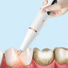 Ridimensionamento dei denti Scaler dentale elettrico Detergente per denti ad ultrasuoni per la rimozione della placca